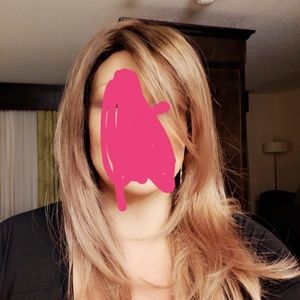 Hair restoration wig